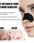 100 Piece Charcoal Blackhead Nose Pore Strips | Nose Pore Strips Effective Blackhead Removal & Pore Cleansing - TrueFormSkin