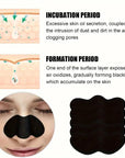 100 Piece Charcoal Blackhead Nose Pore Strips | Nose Pore Strips Effective Blackhead Removal & Pore Cleansing - TrueFormSkin
