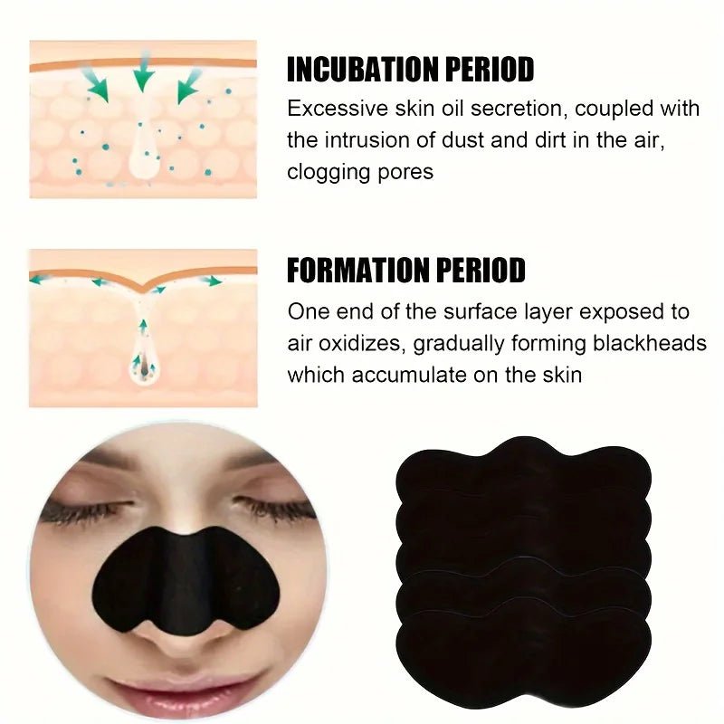 100 Piece Charcoal Blackhead Nose Pore Strips | Nose Pore Strips Effective Blackhead Removal & Pore Cleansing - TrueFormSkin