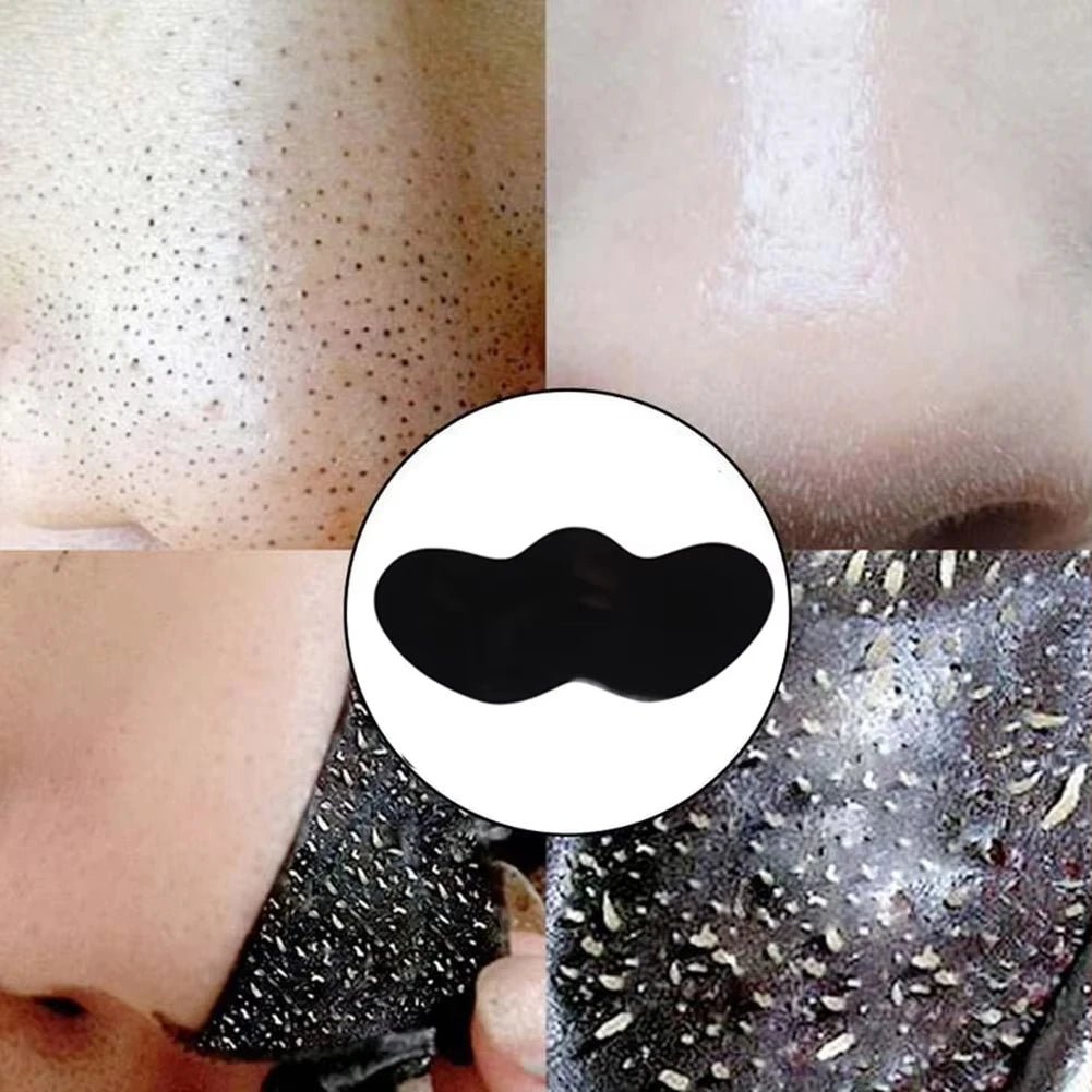 100 Piece Charcoal Blackhead Nose Pore Strips | Nose Pore Strips Effective Blackhead Removal & Pore Cleansing - TrueFormSkin