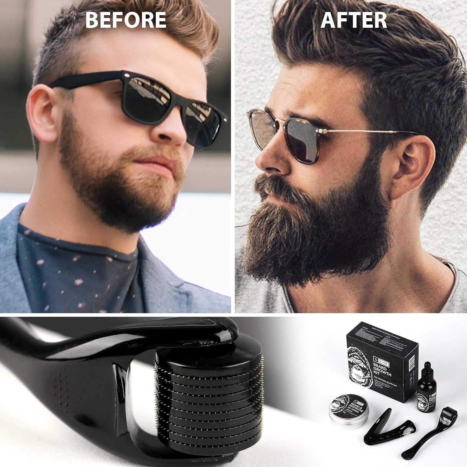 Ultimate Beard Growth Kit - Best Deals UK